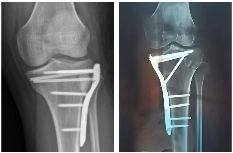 微信圖片_20250425104752 微信圖片_20250425104752